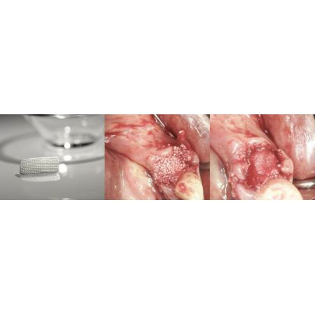 Membrana colagen SinossMem AlveolarRepair