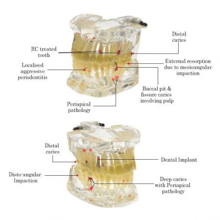 Model studiu patologii dentare adulti