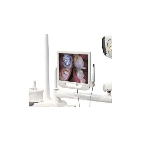 Unit dentar TAOS + Sistem camera intraorala