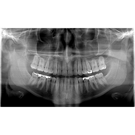 Aparat Radiologie 2D OPG Fona Art Plus