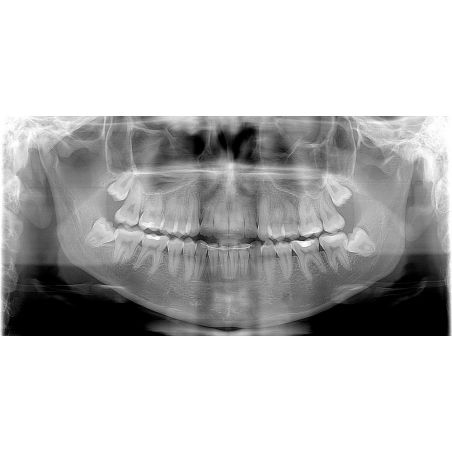 Aparat Radiologie 2D OPG Fona Art Plus