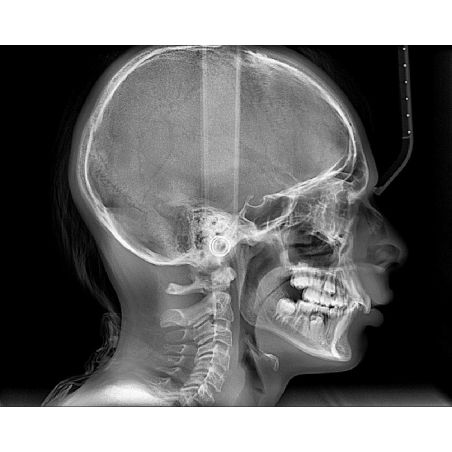 Aparat radiologie ortopantomograf OPG Stellaris 2D cu brat cefalometric