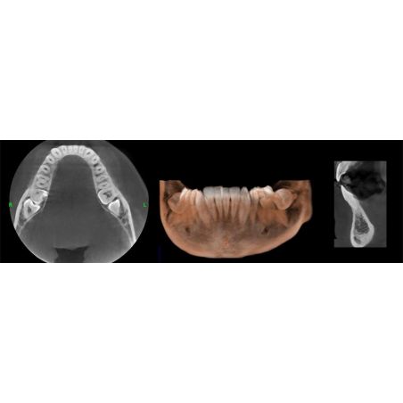 Aparat CBCT Stellaris 3D cu brat cefalometric