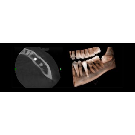 Aparat CBCT Stellaris 3D cu brat cefalometric