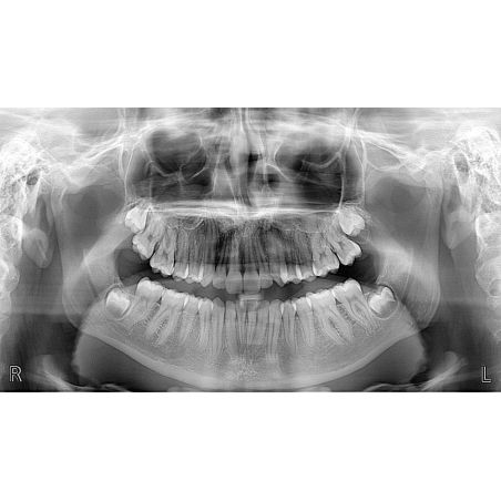 Aparat CBCT Stellaris 3D cu brat cefalometric