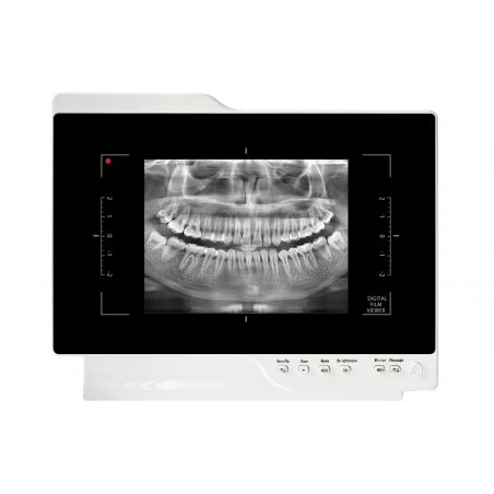 Camera intraorala cu monitor