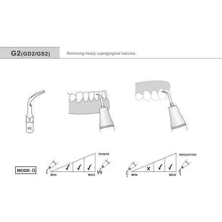 Ansa detartraj supragingival G2 / GS2 / GK2