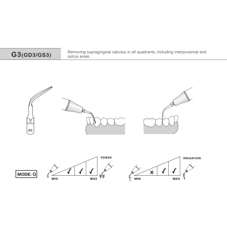 Ansa detartraj supragingival G3 / GK3 / GS3