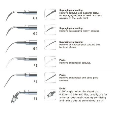 Ansa periodontica subgingivala P1